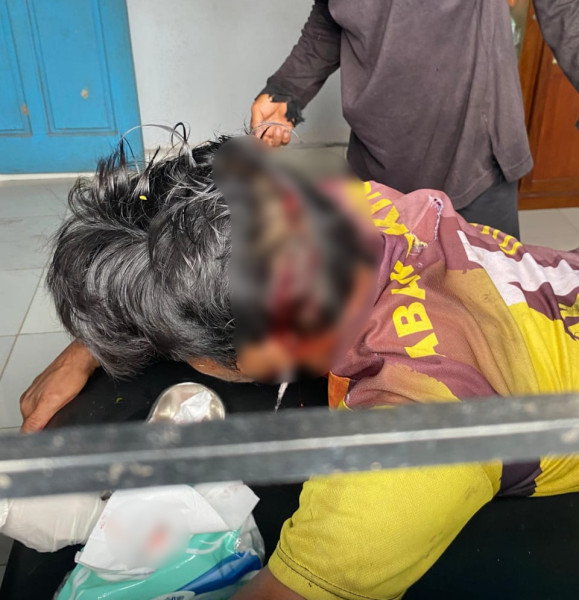 Pekerja Kayu di Siak Diterkam Harimau Saat Istirahat Makan Siang