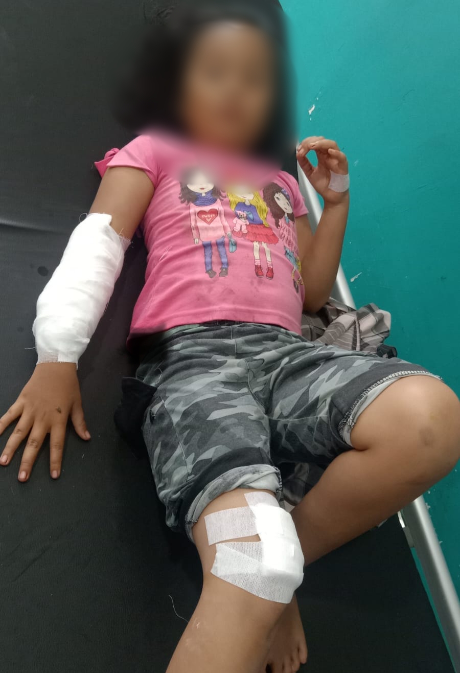 Digigit Siamang Peliharaan Warga, Tangan dan Kaki Bocah 9 Tahun Ini Alami Luka Robek