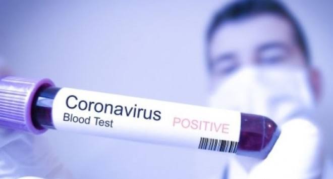 Data Terbaru Kasus Virus Corona di Riau, Hingga Hari Ini Sudah 3.277 Kasus