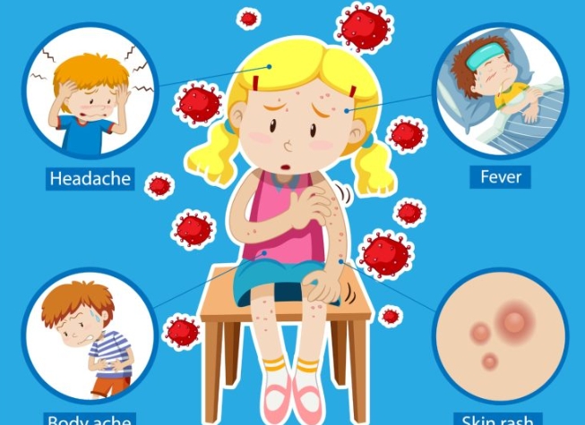 Indonesia Siaga Hadapi Ancaman Virus Mpox